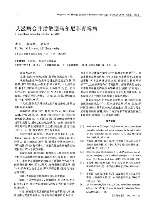 艾滋病合并播散型马尔尼菲青霉病