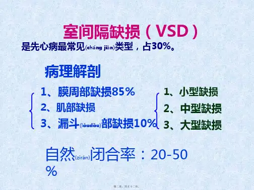 医学专题常见的几种先心病747