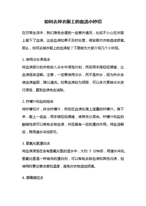 如何去掉衣服上的血渍小妙招