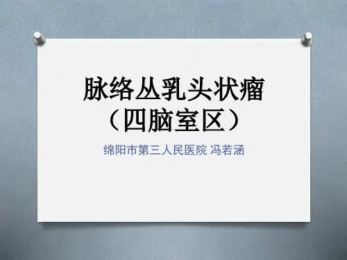 脉络丛乳头状瘤(四脑室区)