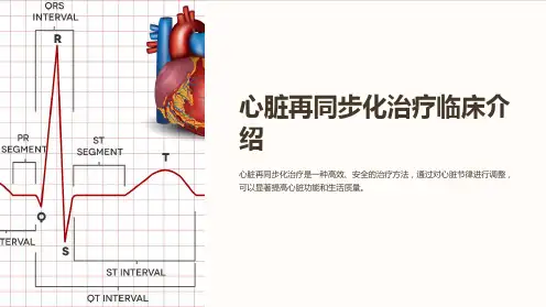 心脏再同步化治疗临床介绍
