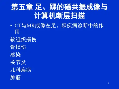 足、踝的磁共振PPT课件