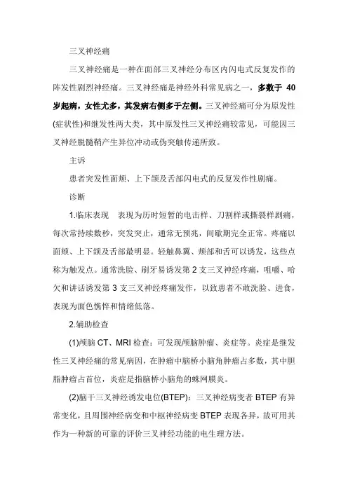 三叉神经痛