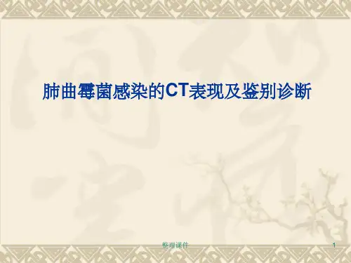 肺曲霉菌感染的CT表现及鉴别诊断