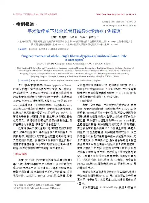 手术治疗单下肢全长骨纤维异常增殖症1例报道