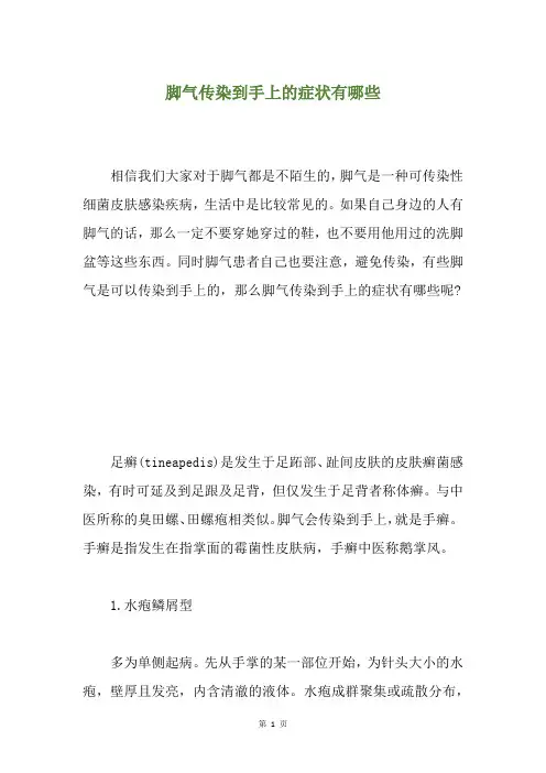 脚气传染到手上的症状有哪些