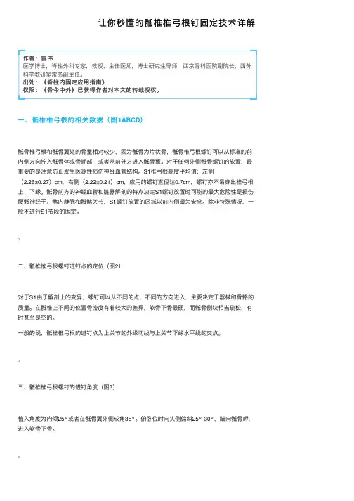 让你秒懂的骶椎椎弓根钉固定技术详解