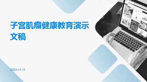 子宫肌瘤健康教育演示文稿