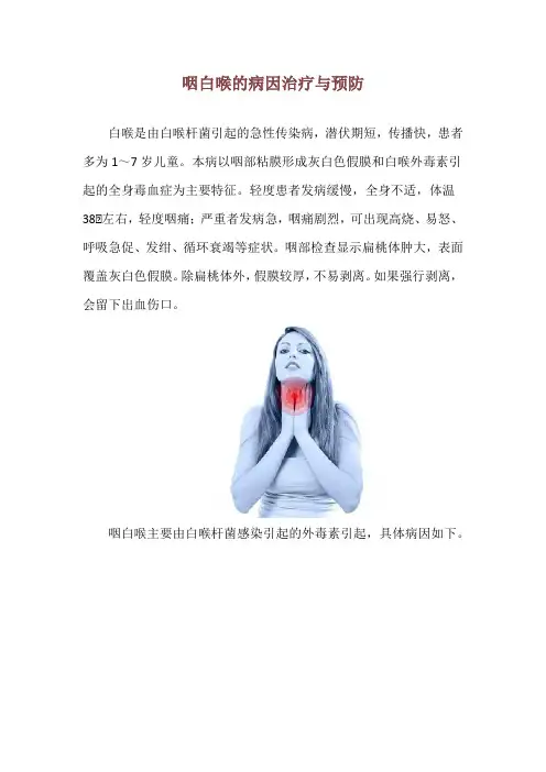 咽白喉的病因治疗与预防