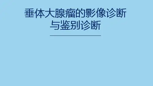 垂体大腺瘤的影像诊断与鉴别诊断