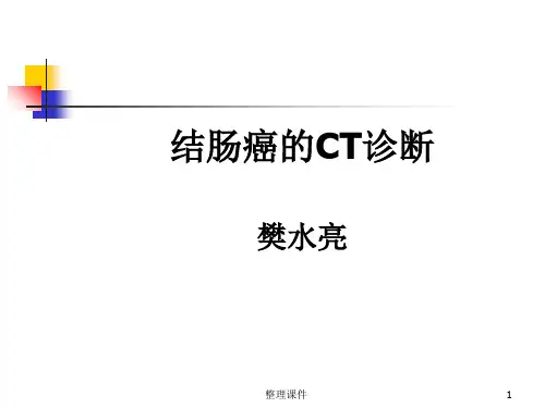 结肠癌的CT诊断