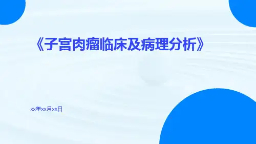 子宫肉瘤临床及病理分析