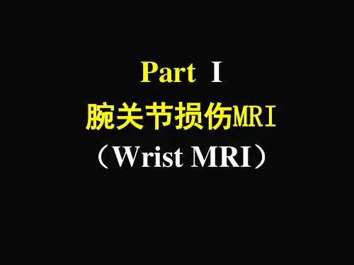 腕关节损伤MRI影像