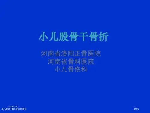 小儿股骨干骨折的诊疗原则