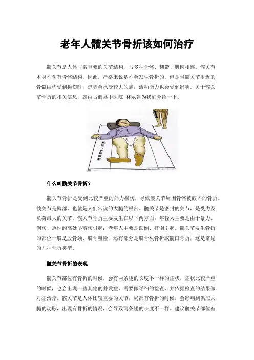 老年人髋关节骨折该如何治疗