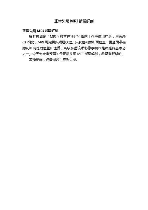 正常头颅MRI断层解剖