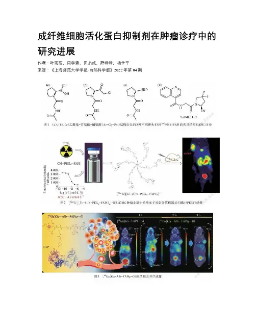 成纤维细胞活化蛋白抑制剂在肿瘤诊疗中的研究进展