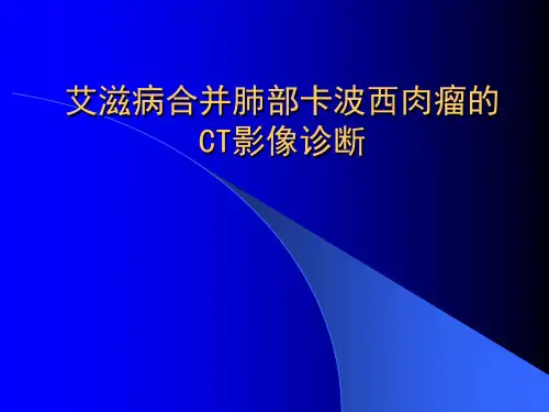 艾滋病合并肺部卡波西肉瘤的CT影像诊断ppt课件