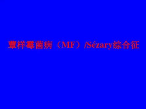 Sezary淋巴瘤