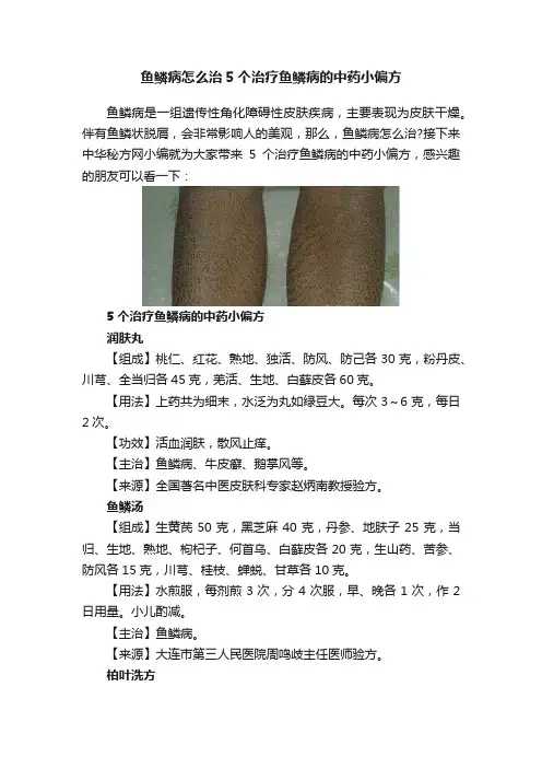 鱼鳞病怎么治5个治疗鱼鳞病的中药小偏方