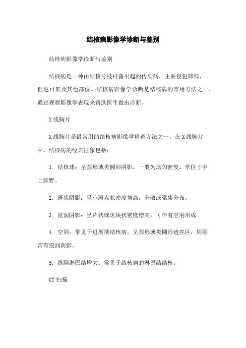 结核病影像学诊断与鉴别