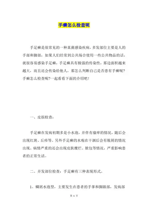 手癣怎么检查呢