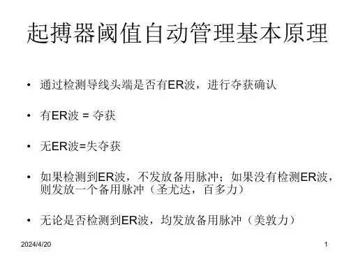 起搏器心室阈值自动管理功能相关的心电学特点课件