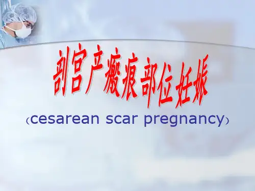剖宫产瘢痕部位妊娠PPT课件