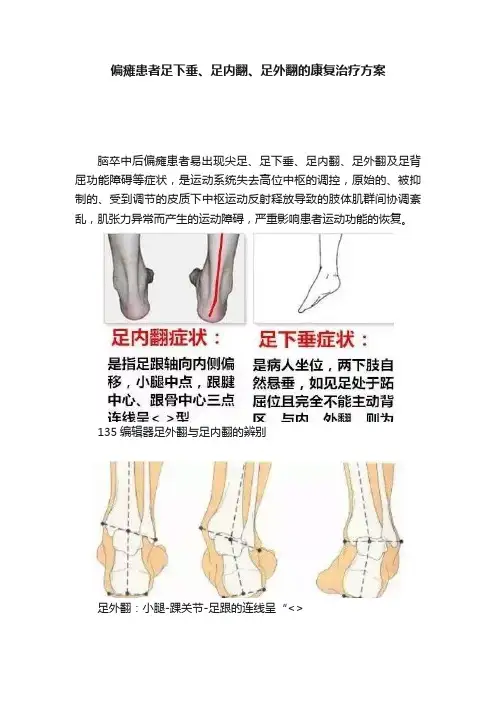 偏瘫患者足下垂、足内翻、足外翻的康复治疗方案