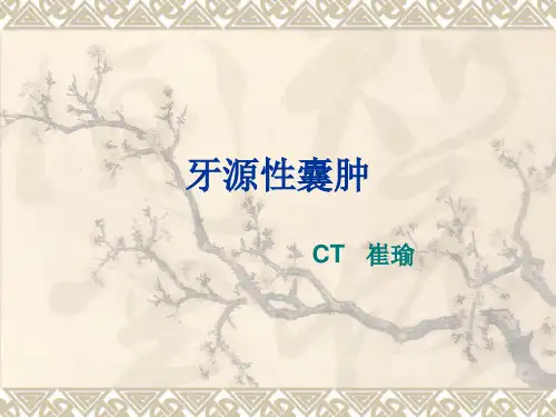 牙源性囊肿CT影像表现