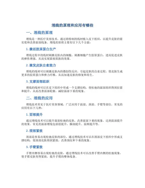 埋线的原理和应用有哪些