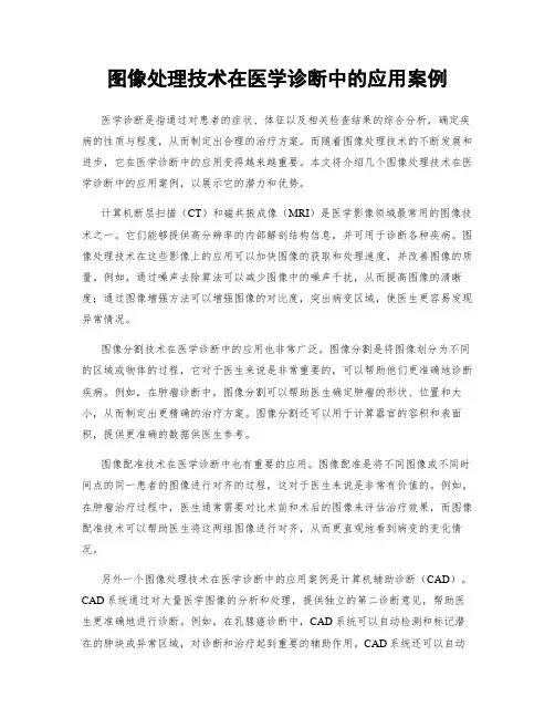 图像处理技术在医学诊断中的应用案例