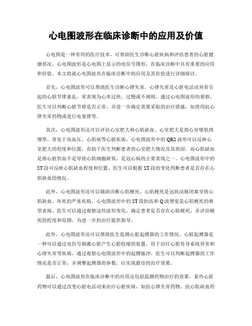 心电图波形在临床诊断中的应用及价值