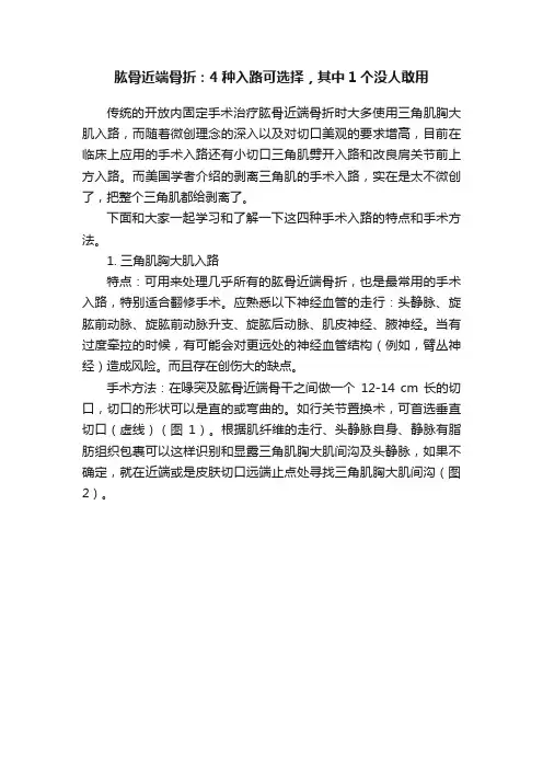 肱骨近端骨折：4种入路可选择，其中1个没人敢用