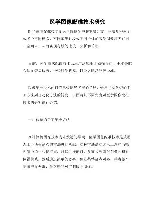 医学图像配准技术研究