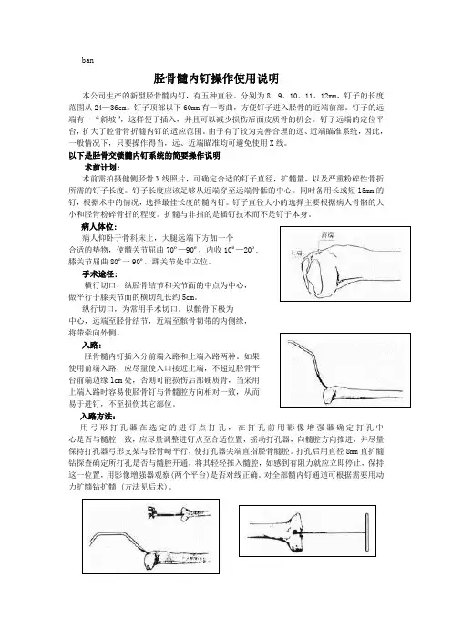 胫骨髓内钉操作使用说明