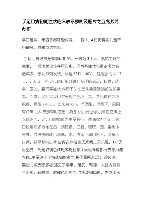 手足口病初期症状及图片-手足口病症状图片