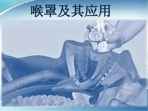 喉罩