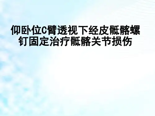 仰卧位C臂透视下经皮骶髂螺钉固定治疗骶髂关节损伤PPT学习课件