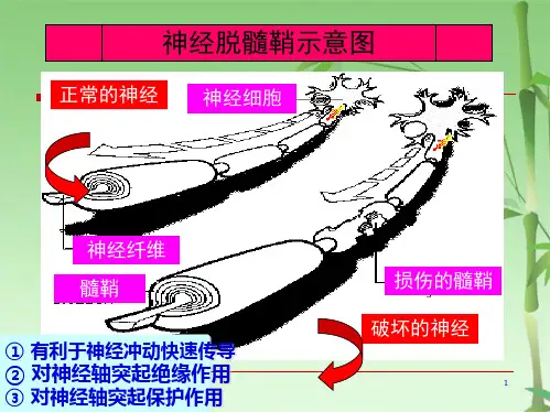 多发性硬化ligang(共54张PPT)