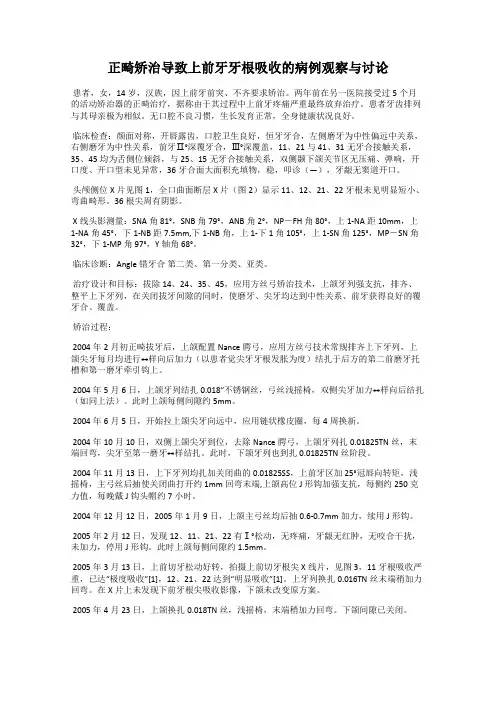 正畸矫治导致上前牙牙根吸收的病例观察与讨论