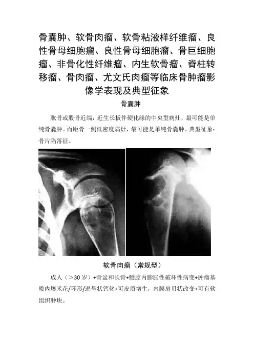 骨囊肿、软骨肉瘤、良性骨母细胞瘤、骨巨细胞瘤、非骨化性纤维瘤、骨肉瘤等临床骨肿瘤影像学表现及典型征象
