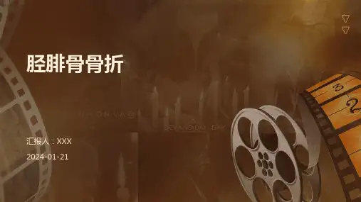 胫腓骨骨折演示课件