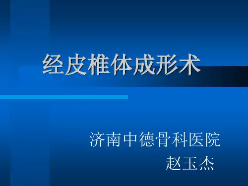 椎体成形术(PVP)