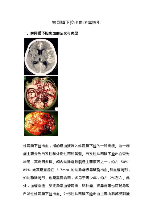 蛛网膜下腔出血迷津指引