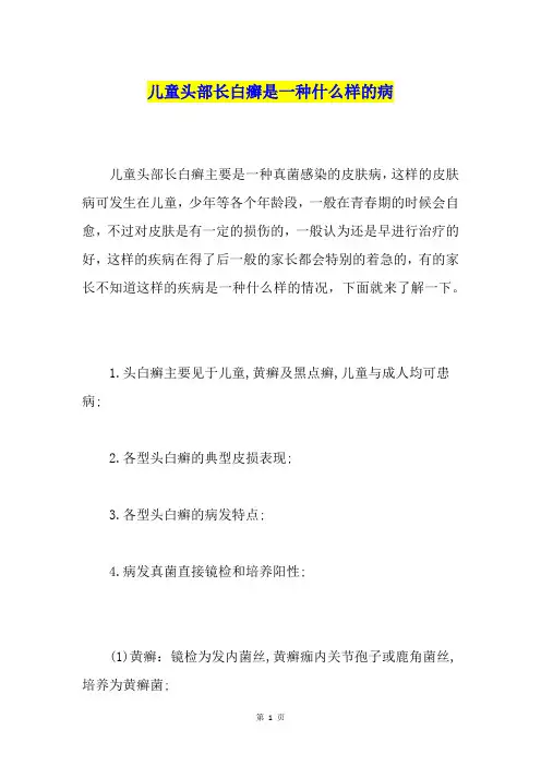 儿童头部长白癣是一种什么样的病