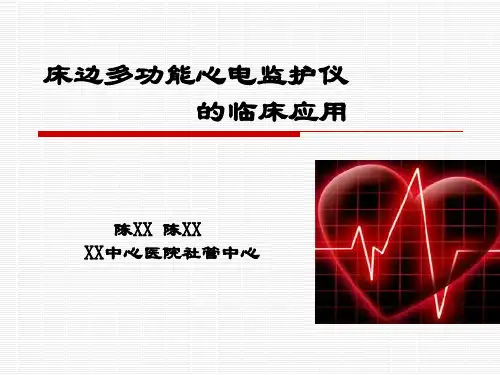 多功能心电监护仪的应用