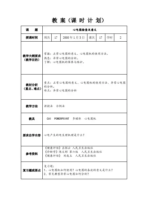 心电图检查和意义