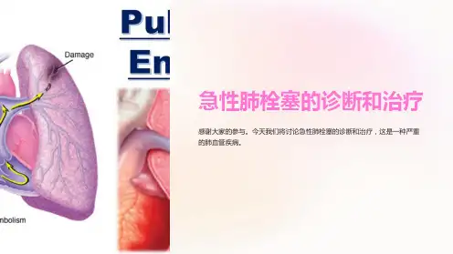急性肺栓塞的诊断和治疗