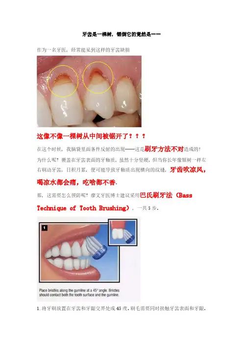 巴氏刷牙法